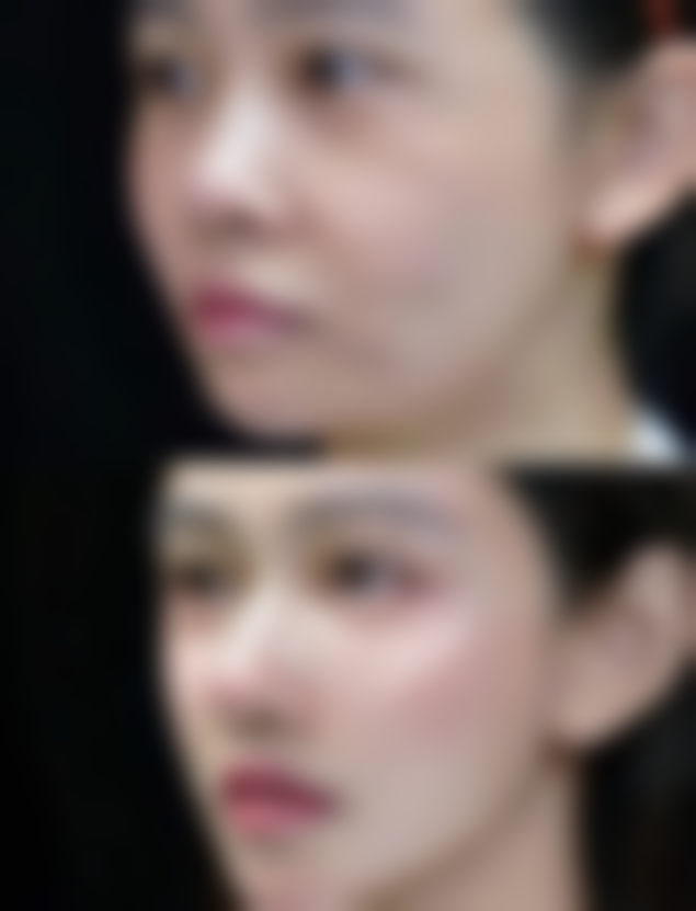 青岛懿后唐美人医疗美容诊所收费标准参考