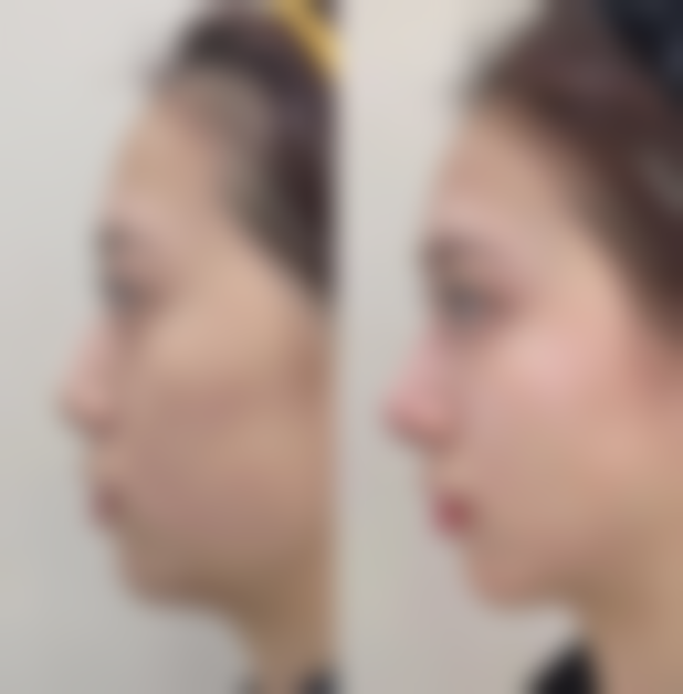 重庆星薏整形医院电话号码及预约方法