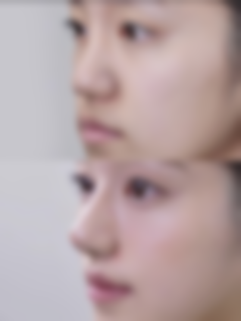 武汉甄美医疗美容整形医院医院技术好不好？