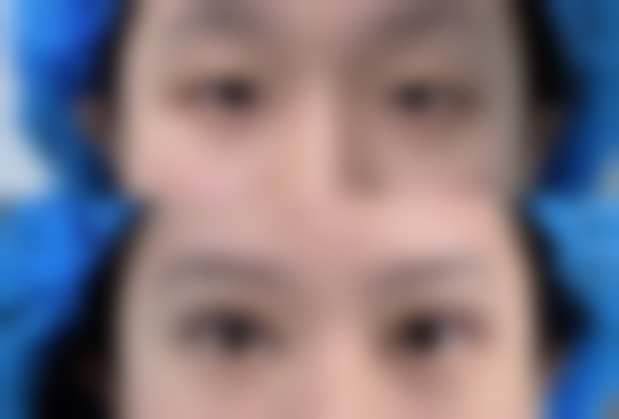 河北沧州红提医疗整形医院口碑如何？