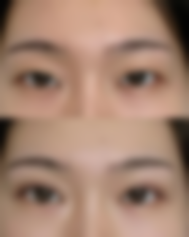 广安阿蓝整形美容医院收费标准参考