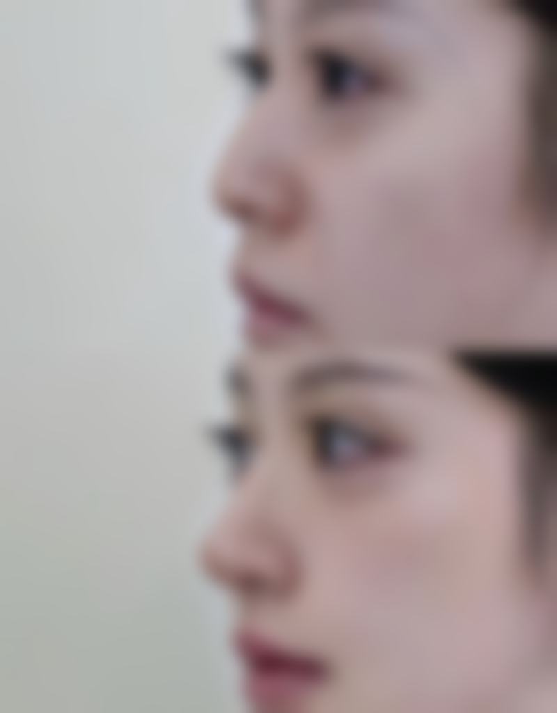 总结——海南优嘉舒颜医疗美容诊所庄静玲医生怎么样？