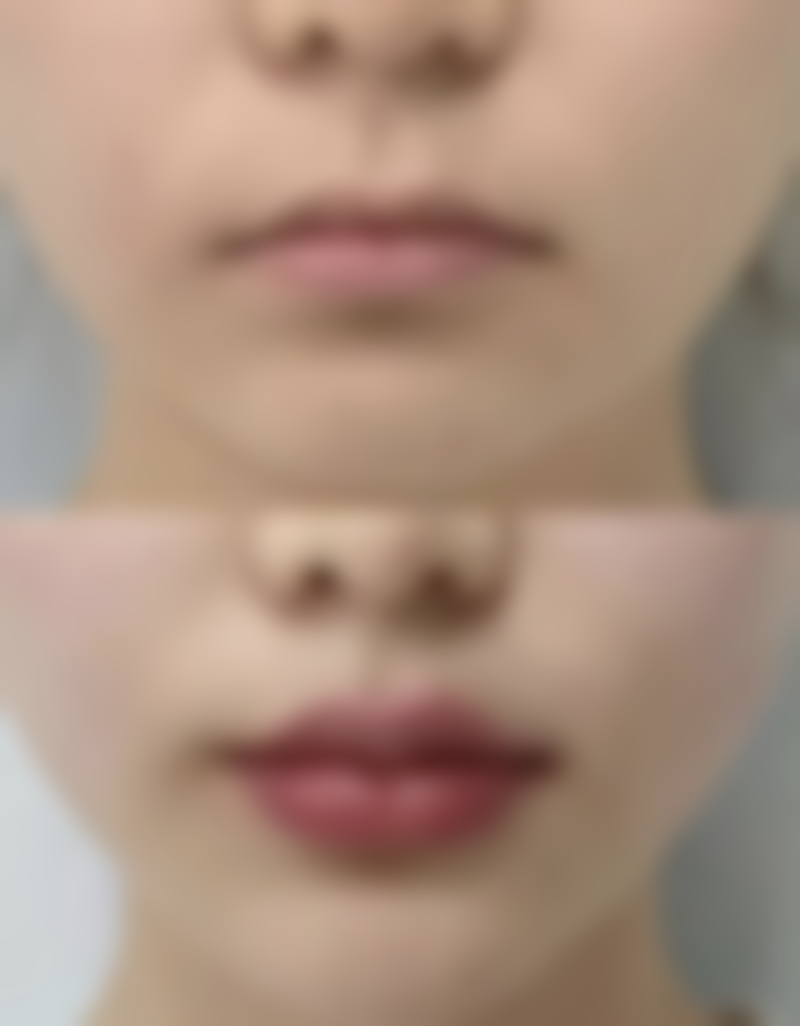 金华丽都整形门诊医院技术好不好?