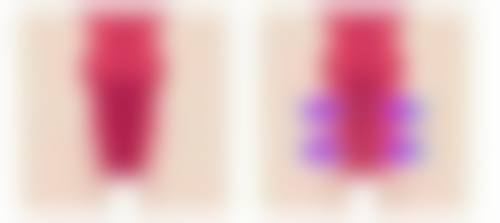 韩国她美TAMI整形外科皮肤科硬件设备精良！