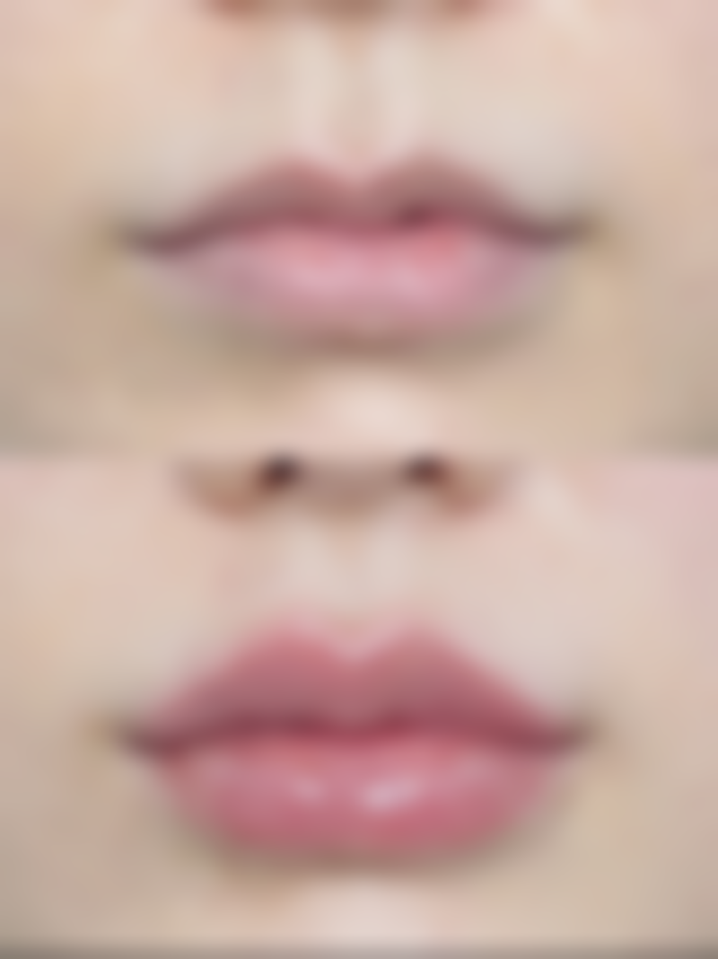 沈阳臻美蒂梵妮整形医院口碑如何？