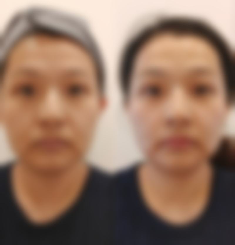 沈阳臻美蒂梵妮整形医院医院技术好不好？