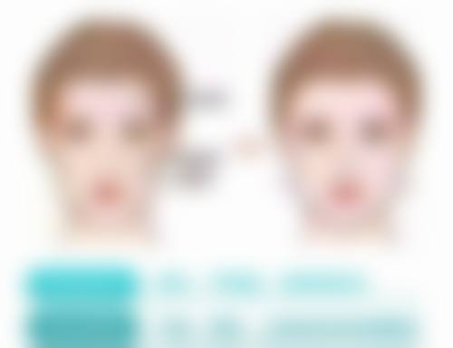 男士进行眼袋手术后需要注意什么