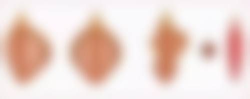 深圳星禾医疗美容门诊部卢钟勋医生挂号预约攻略