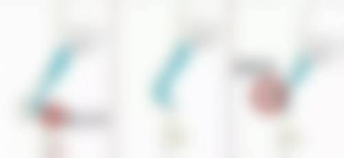 深圳星禾医疗美容门诊部卢钟勋医生技术好不好?