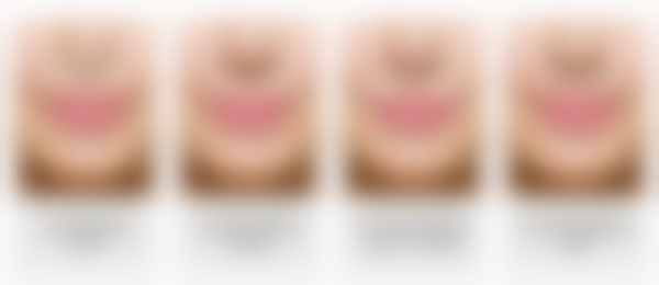 韩国V&MJ金薇整形外科营业时间