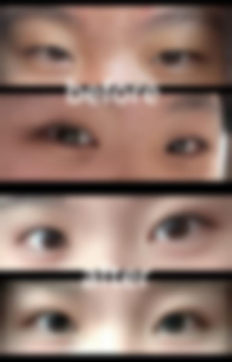 麻醉方式的选择