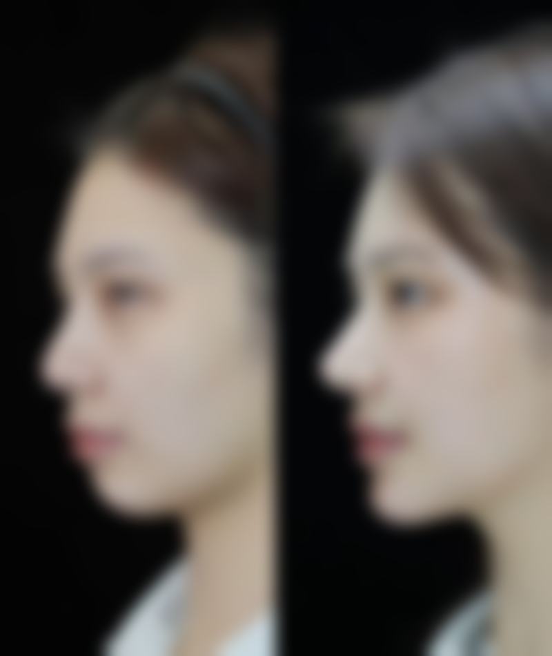 上海百汇医院医疗美容科口碑如何？