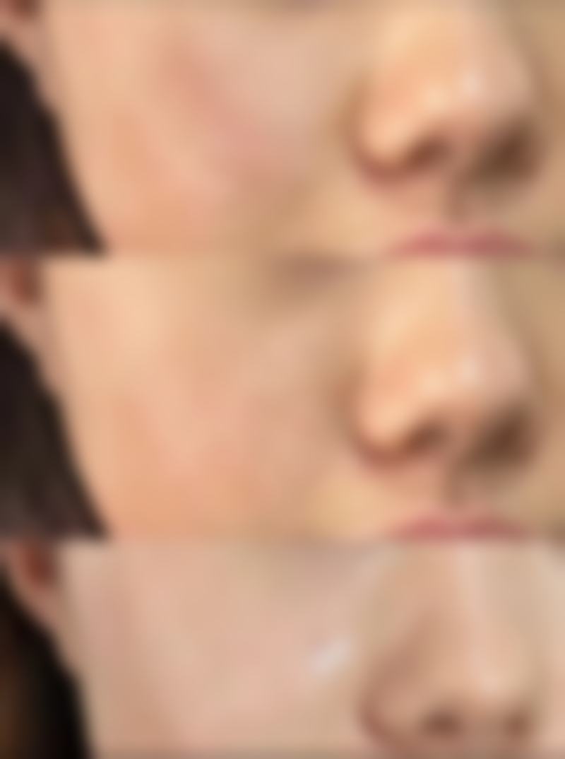 深圳星禾医疗美容门诊部卢钟勋医生技术好不好?