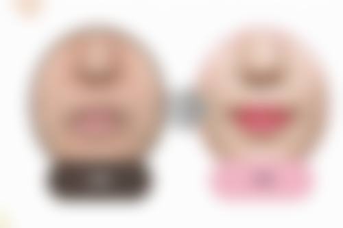 昆明精东植发地址