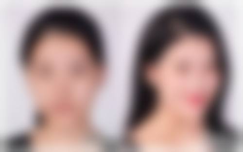 青海红十字医院(皮肤美容科)医院技术好不好？