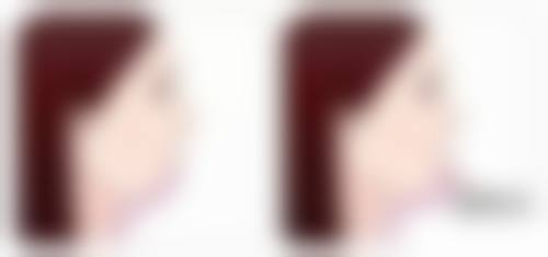 昭通爱丽诺整形美容医院医院技术好不好?