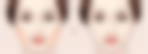 骨粉隆鼻可以取出吗？取出难度大、次数不定，费用和术后护理有啥门道