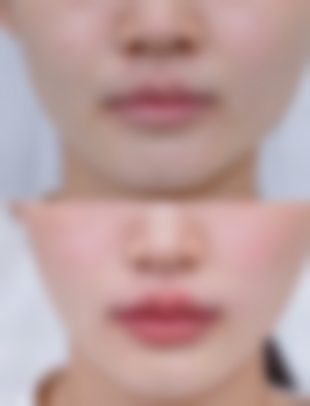 温州华悦医疗美容诊所覃金华医生口碑评价如何？