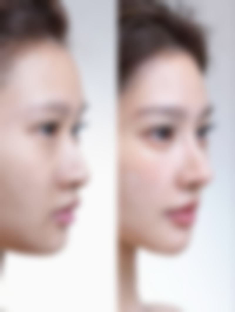 长沙爱馨整形医院收费标准参考