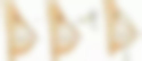 总结——长沙爱馨整形医院雷医生怎么样?