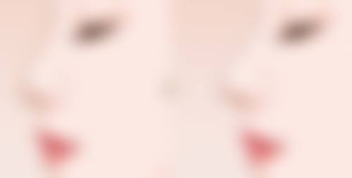 长沙爱馨整形医院雷医生口碑评价如何?