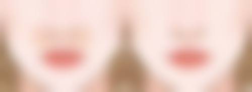 长沙爱馨整形医院雷医生技术好不好?