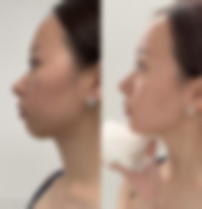 长沙爱馨整形医院贺珊婷从医荣誉