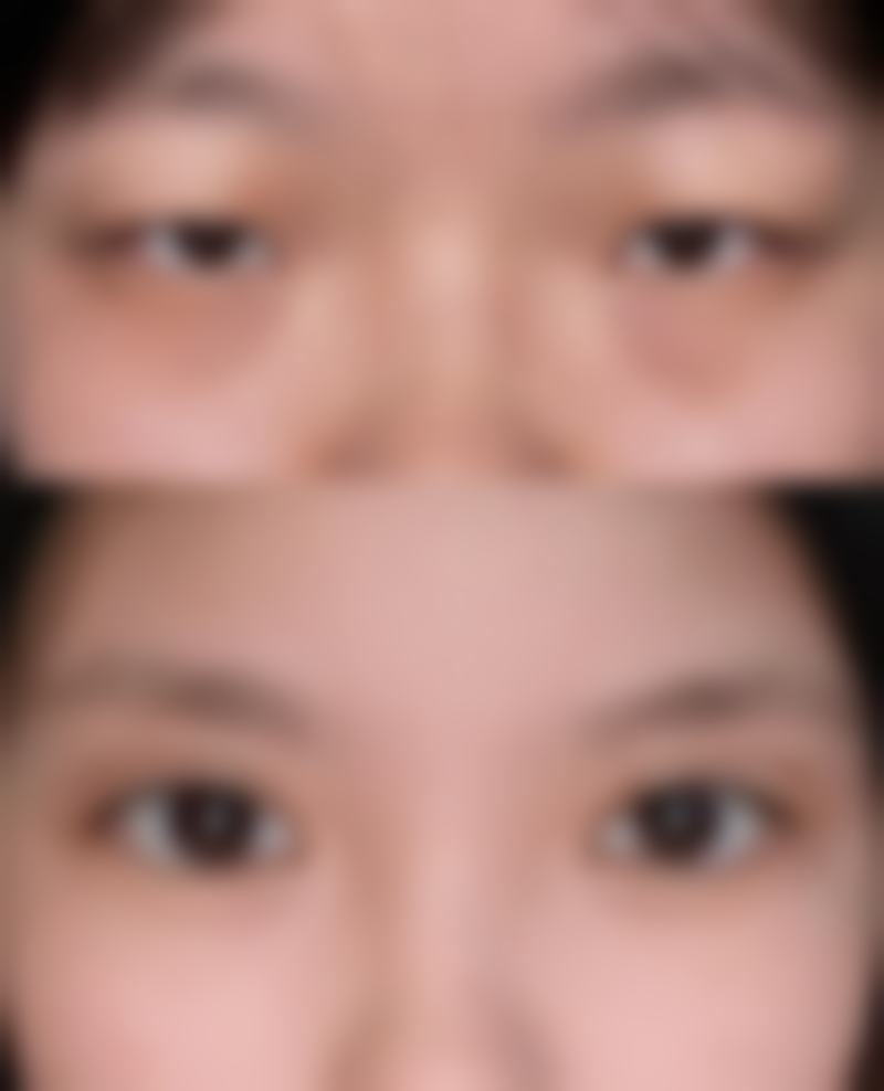 韩国Thenan整形外科收费标准参考