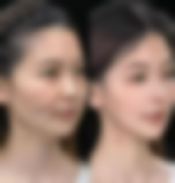 KIBBUM整形医院地址