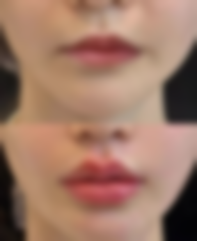 关于隆鼻和医院的相关信息