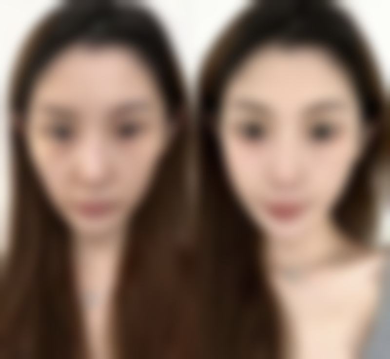 宁波鄞州壹加壹整形医院口碑如何?