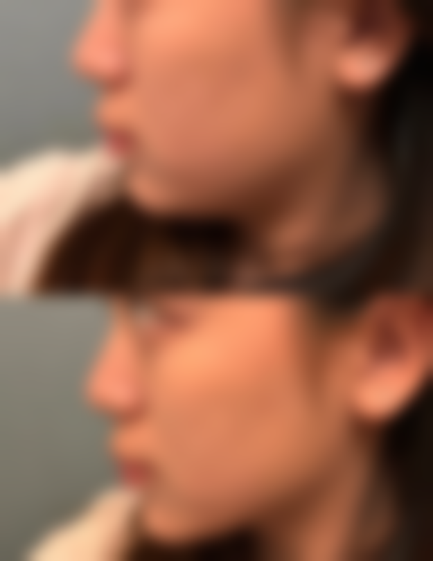 台北维格整形医疗美容门诊部医院技术好不好？