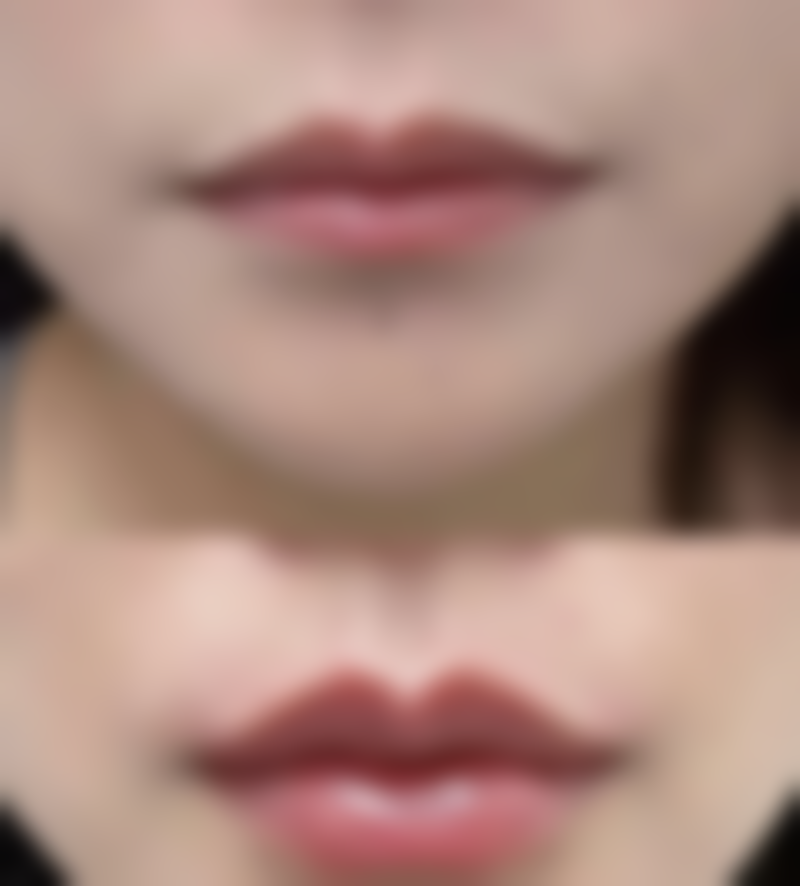 总结——南通俪人连天美医疗美容医院怎么样?