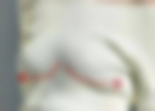 深圳星禾医疗美容门诊部卢钟勋医生口碑评价如何?