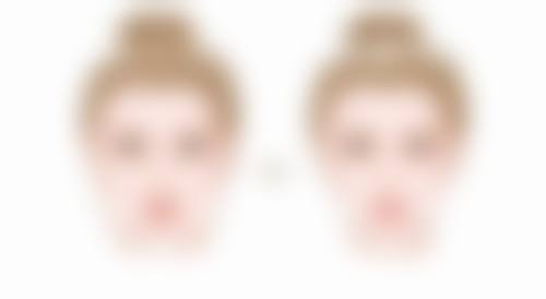 宁波鄞州壹加壹整形医院郭光烨医生简介资料