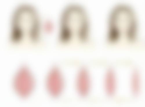 隆胸手术有什么危险？术中感染、假体问题、术后不适及心理负担都要警惕