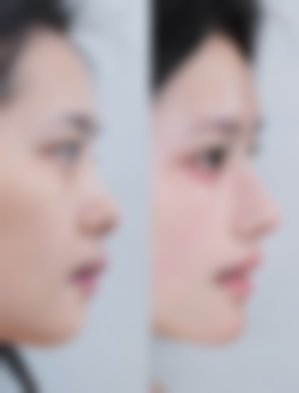 总结——韩国鼻整形研究所 