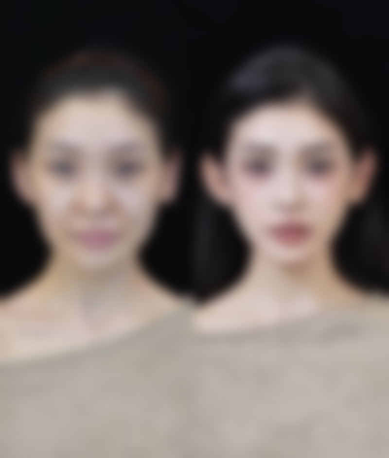 总结——宁波鄞州壹加壹整形医院茅来发医生怎么样？