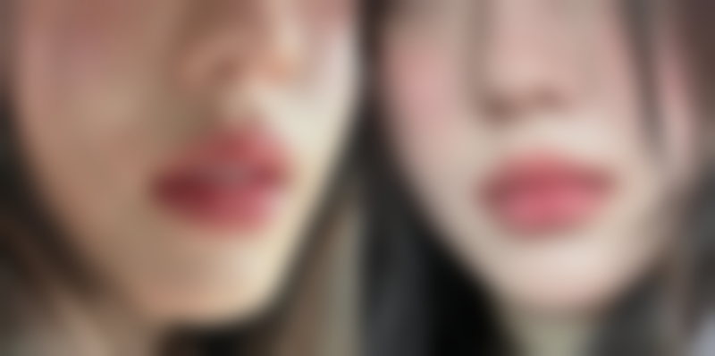 宁波鄞州壹加壹整形医院张跃伟医生口碑评价如何?