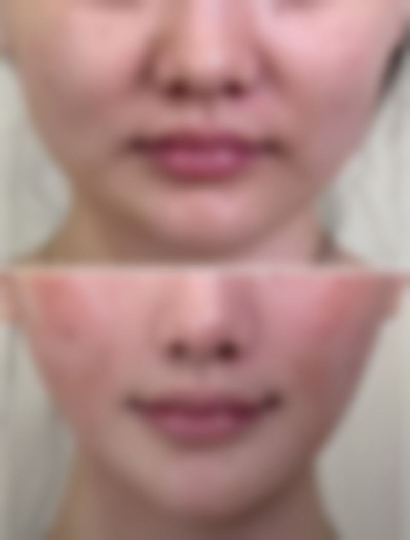 总结——宁波鄞州壹加壹整形医院郭光烨医生怎么样?