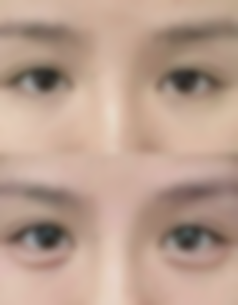 南京安安医疗美容收费标准参考