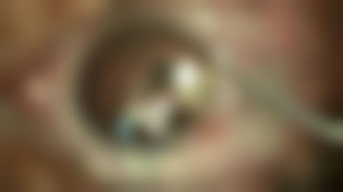 总结——韩国Liting整形外科怎么样？