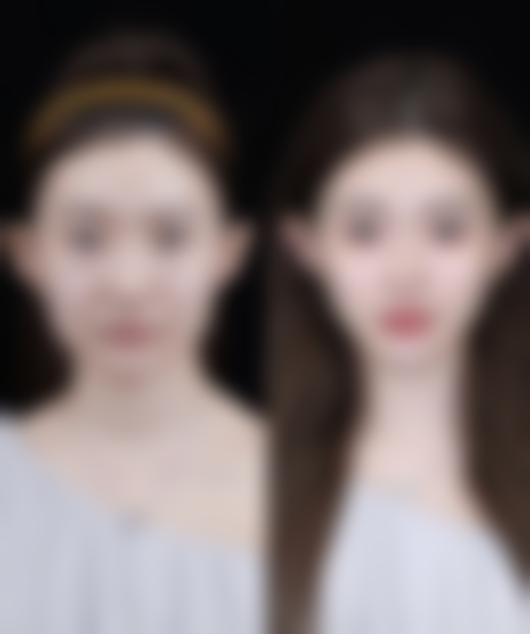 如何降低自体隆胸的危害