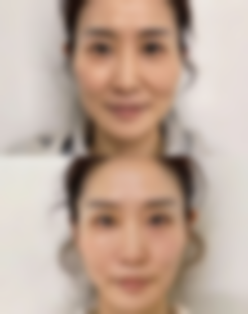 广州458医院整形美容科陈柯医生口碑评价如何？