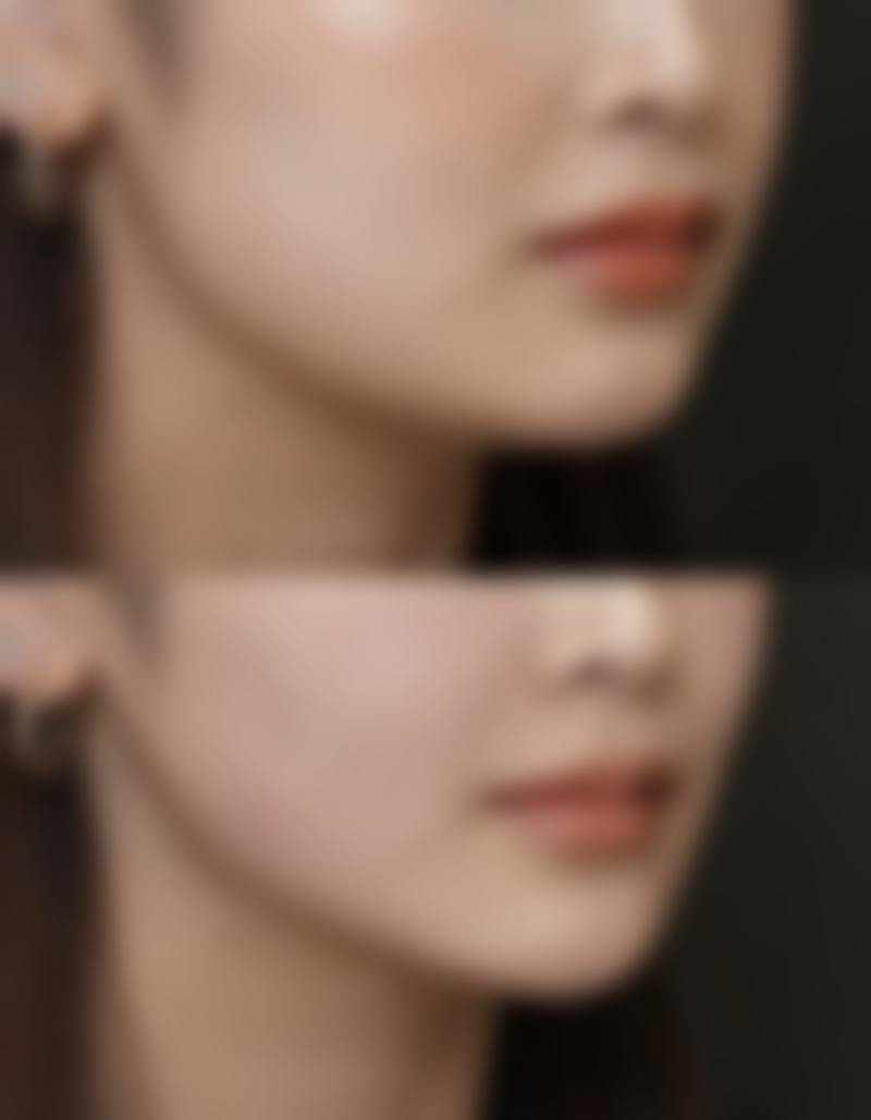 宁波鄞州壹加壹整形医院郭光烨医生挂号预约攻略