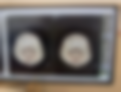 江西九三关怀医院医院技术好不好？