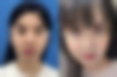 吉林省人民医院(医美科)医院技术好不好？