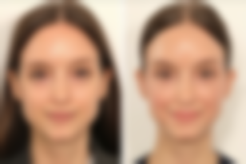 廊坊力康整形门诊电话号码及预约方法