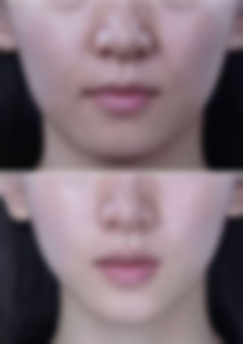 总结——福州添媛美医疗美容门诊部怎么样?