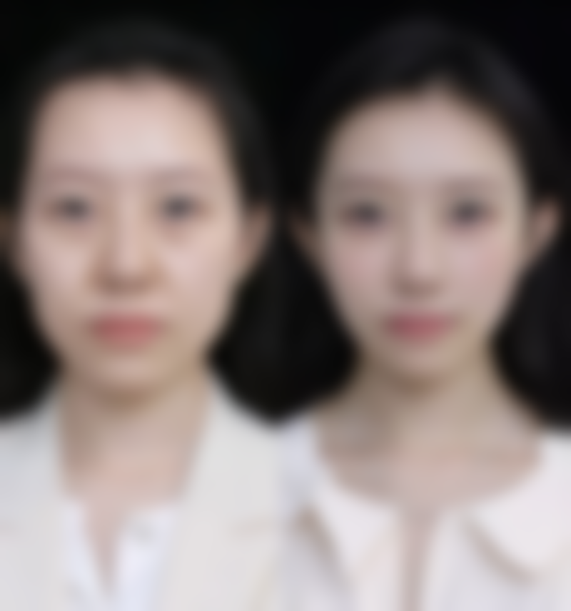 吉林省人民医院(医美科)硬件设备精良！